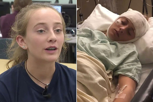 After A Head Injury, This Teen's Memory Resets Every Two Hours And She ...