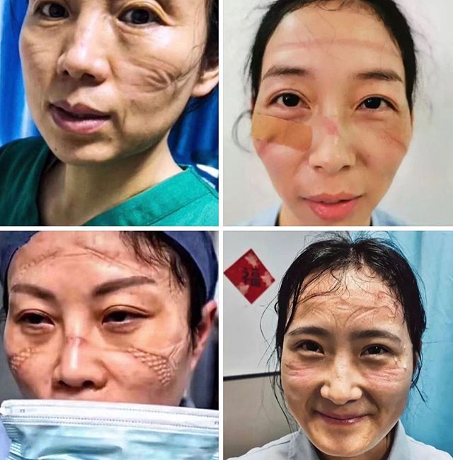 chinese nurses faces coronavirus